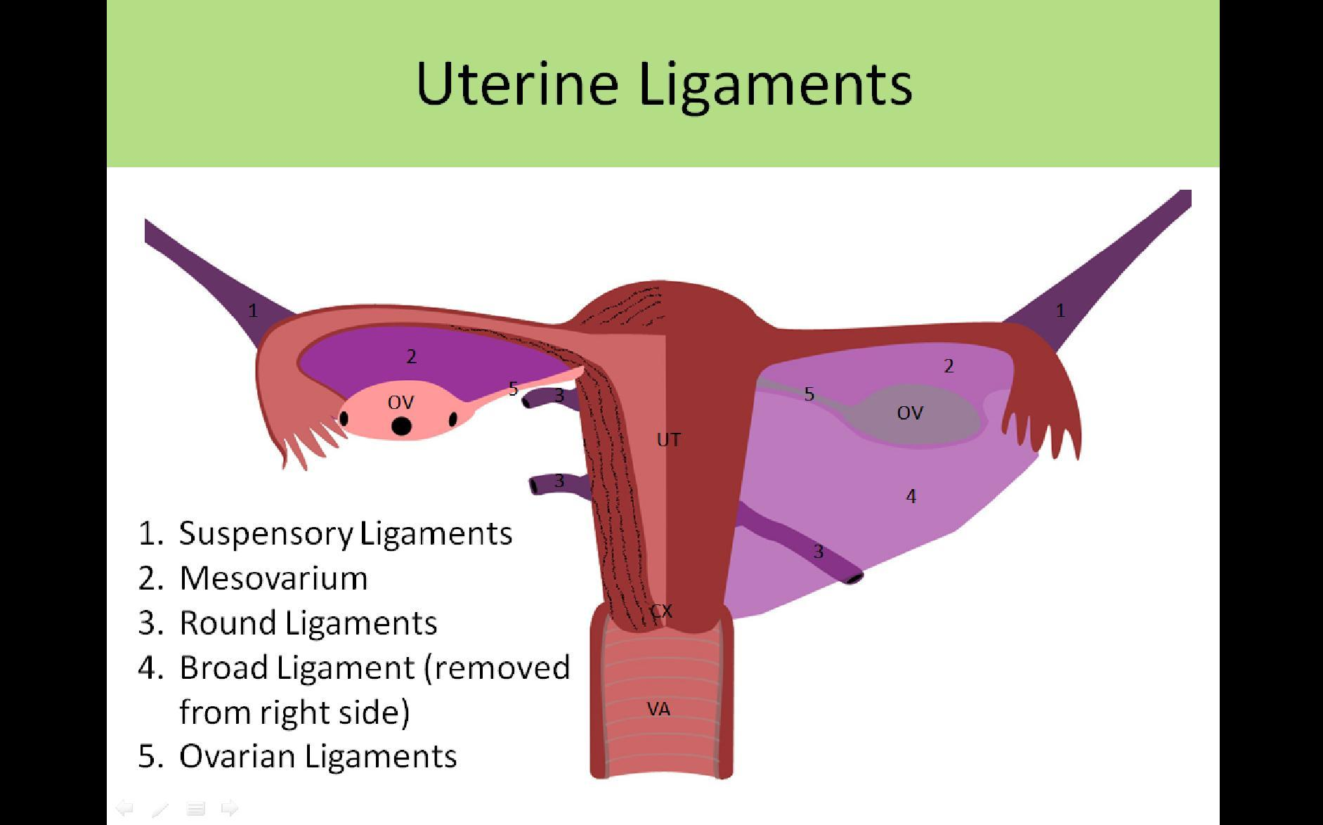 <p>B. Broad and suspensory</p><ul><li><p class=""><strong>uterine vessels</strong> run within the <strong>broad ligament</strong> (specifically the mesometrium).</p></li><li><p class="">The <strong>ovarian vessels</strong> travel within the <strong>suspensory ligament of the ovary</strong> (also called the infundibulopelvic ligament)</p><ul><li><p class=""><strong>ovarian ligament</strong> connects ovary to uterus but does not contain major vessels.</p></li><li><p class="">The <strong>round ligament</strong> has no major vessels related to these structures.</p></li></ul></li></ul><p></p>