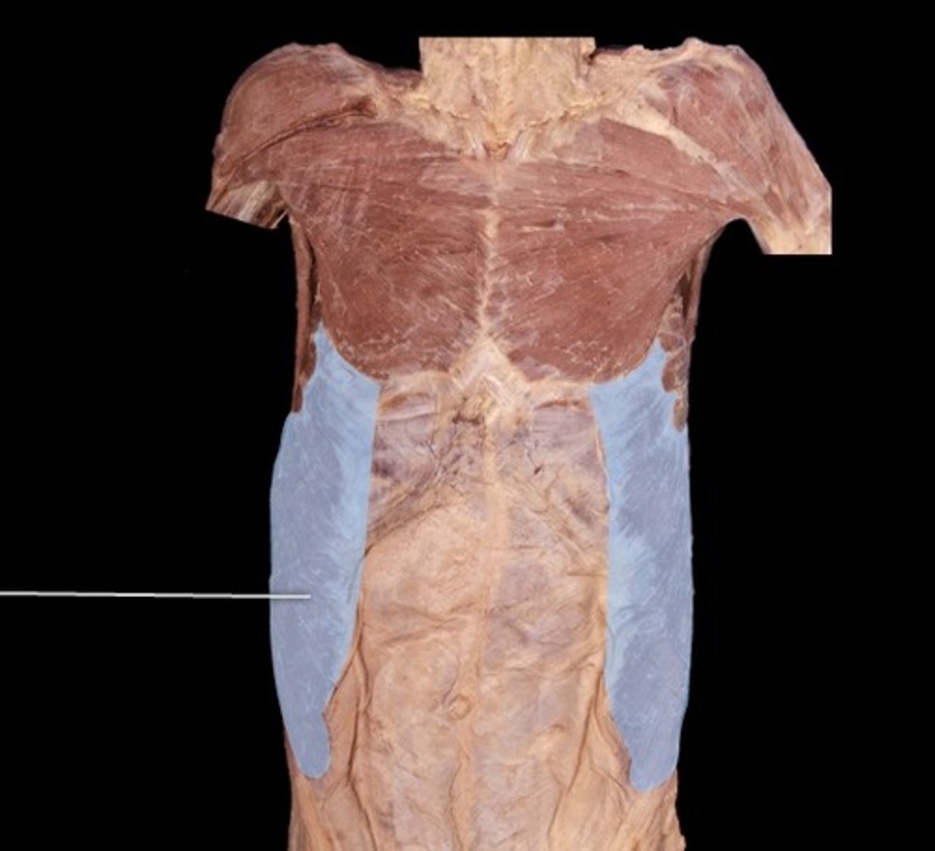 <p>Ribs and costal cartilages 5-12</p>