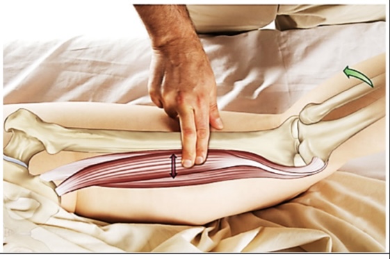 <p>semintendinosus</p>