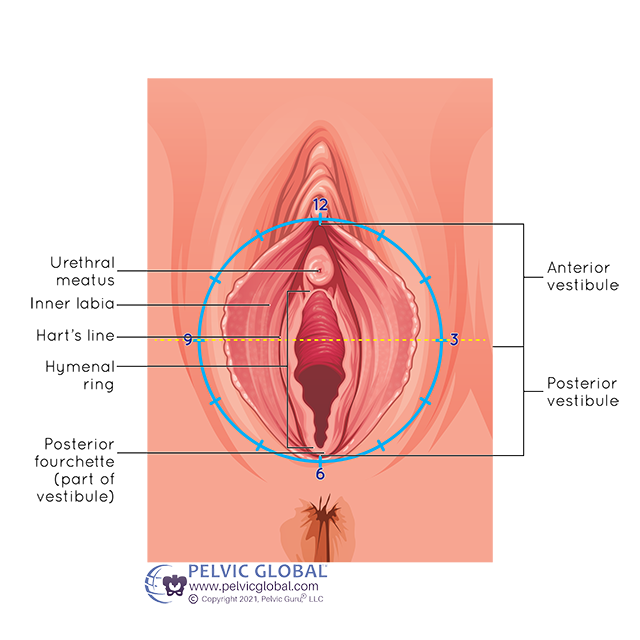 <p>perineal</p>