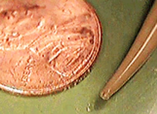 <ol><li><p>SN</p></li><li><p>PS</p></li><li><p>DH</p></li><li><p>Ant/Post end</p></li></ol><p></p>