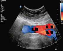 <p>Label the crossed-out structures on this image.&nbsp;</p>