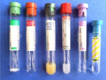 <p>What do all these large animal tubes contain (left to right)</p>