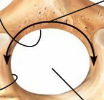 <ul><li><p>Opening in vertebral arch</p></li><li><p>Spinal cord passes through</p></li></ul><p></p>