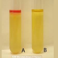 <p>What results can you gather from tube A?</p>