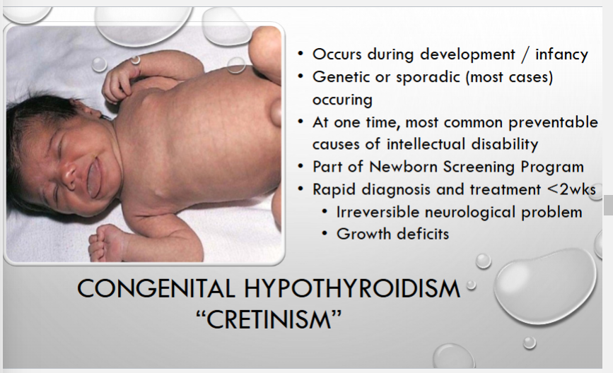 <p>is now part of neonatal screening</p>