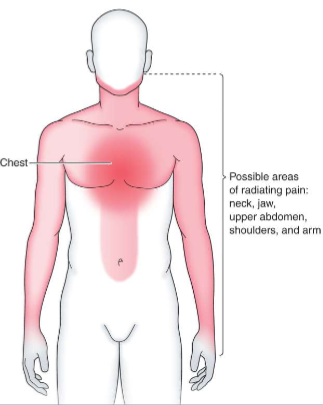 <p>True/False: Most tests done for angina pectoris and MI pain and symptoms were performed on men, not women</p>