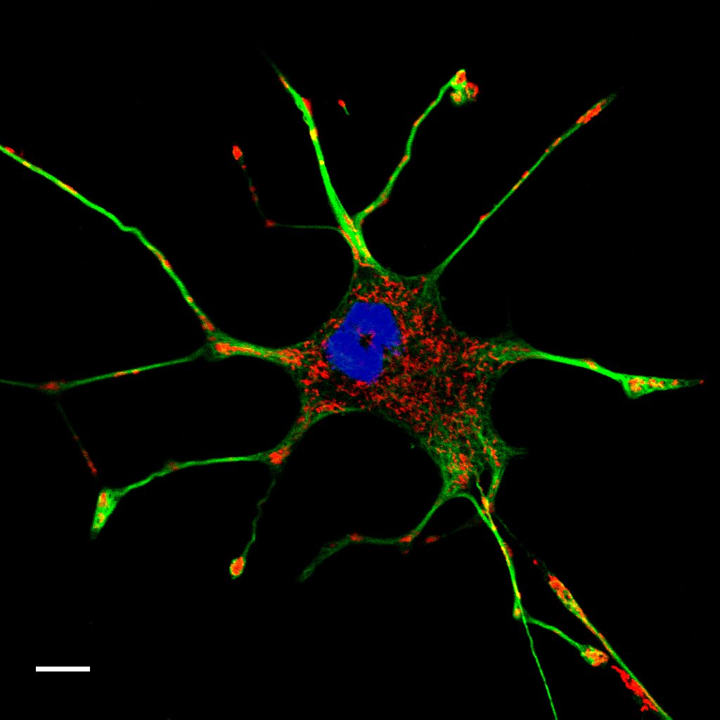 <p>neurotubles within axon </p>