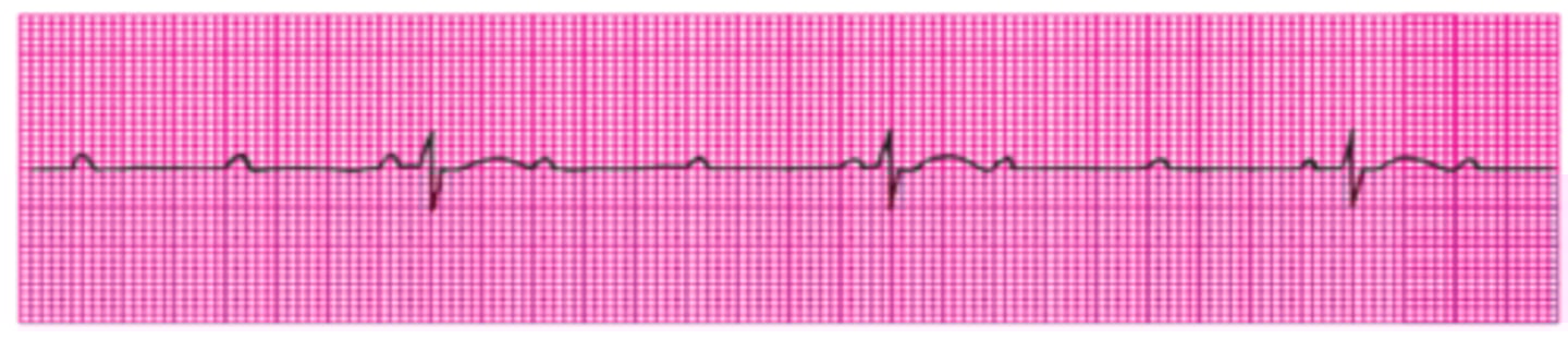 <p>Name this rhythm.</p>