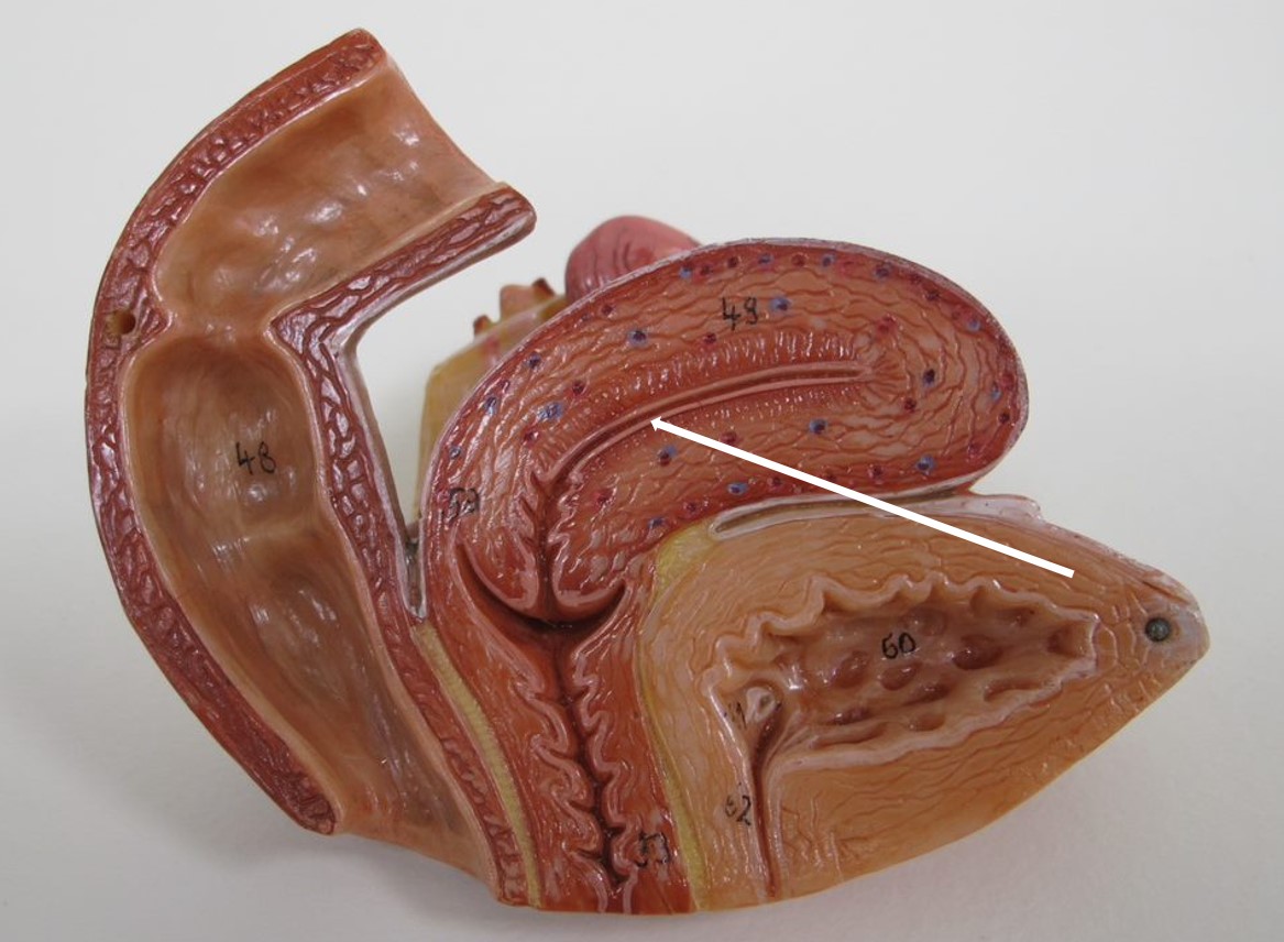 <p>deel uteruswand</p>