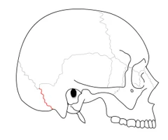 <p>Right Lateral View</p>