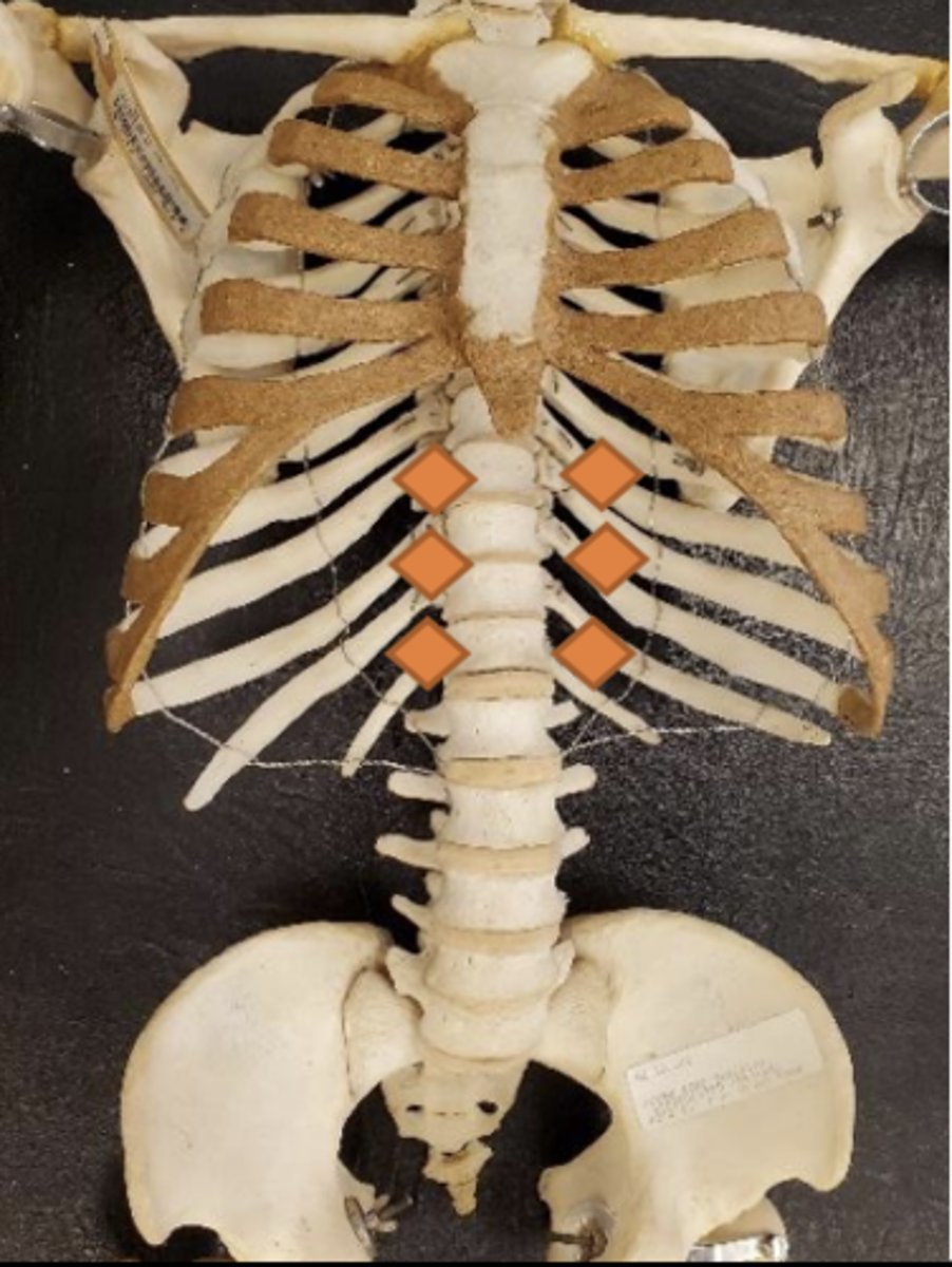 <p>3/4 distance between xiphoid and umbilicus; just lateral to midline bilaterally</p>