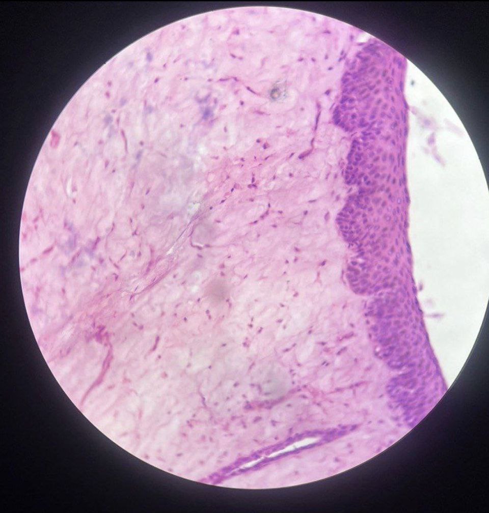 <p>Identify the tissue and mention one site</p>