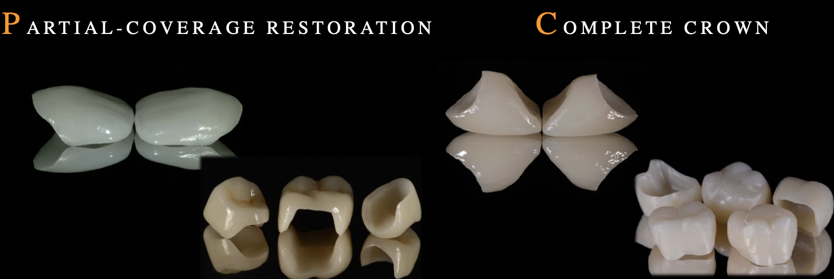 <ul><li><p>partial coverage restoration </p></li><li><p>complete crowns </p></li></ul><p></p>