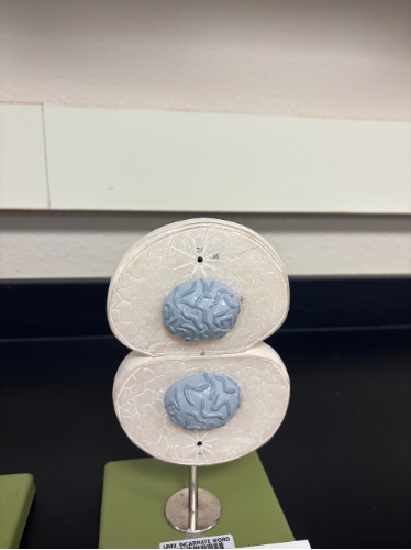 <p>What stage of mitosis is this? </p>