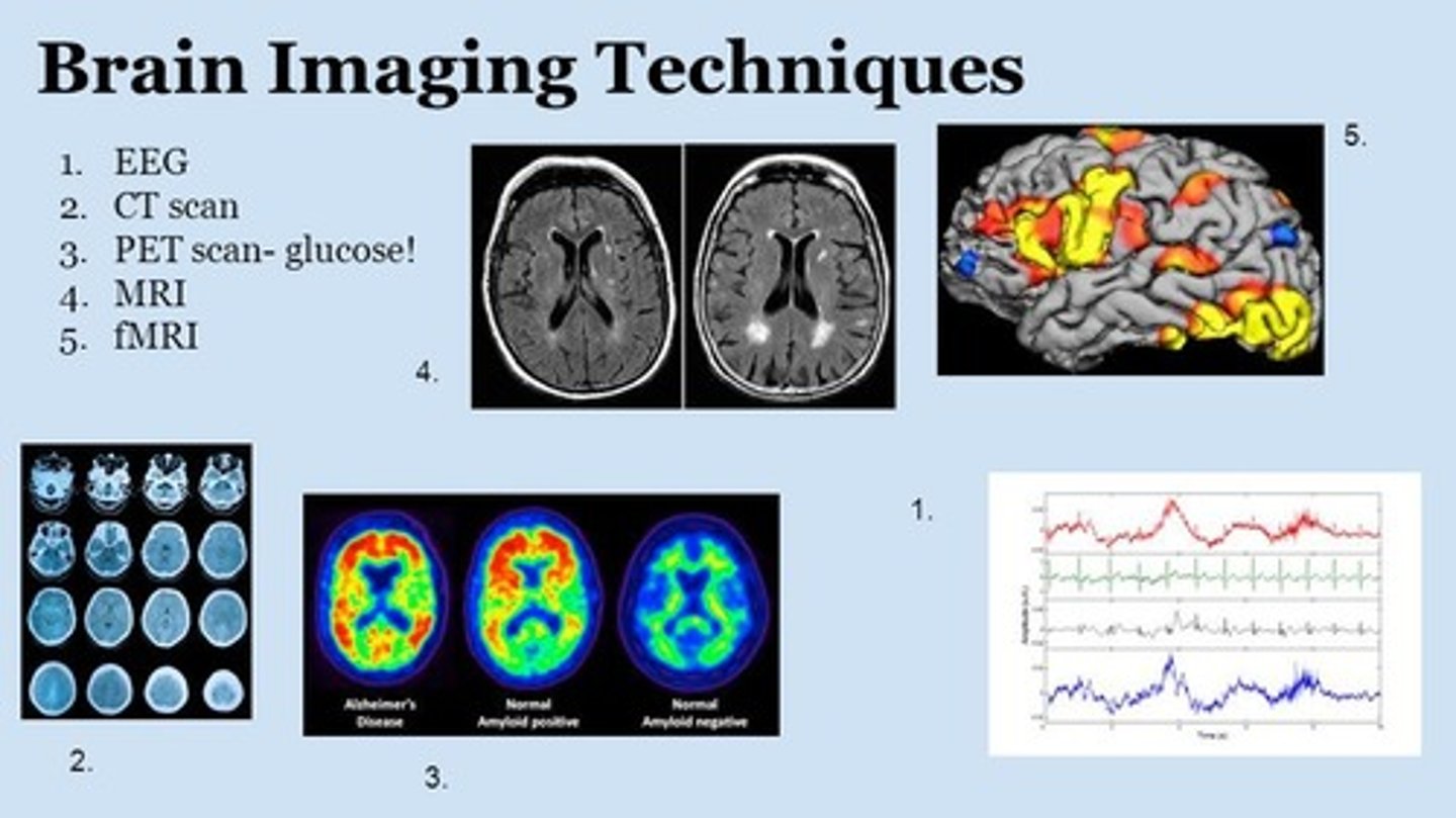 <p>(C) II &amp; III only</p><p>Both EEG &amp; MEG tell us about the brain function. In addition, fMRI &amp; PET do the same with the added bonus of telling us about the brain structure as well as function.</p>
