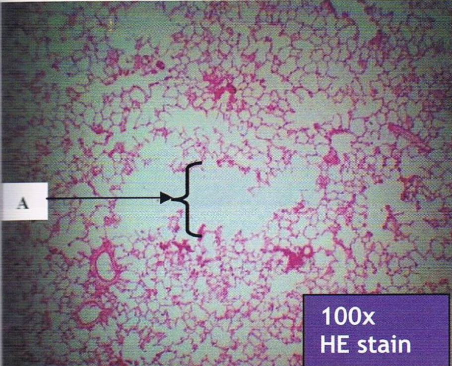 <p>Identify the structure</p>