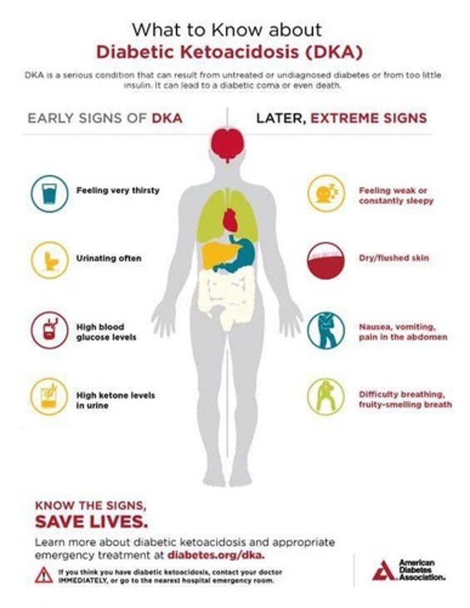 <p>A serious condition characterized by high blood sugar and ketones, often triggered by stress or insufficient insulin.</p>