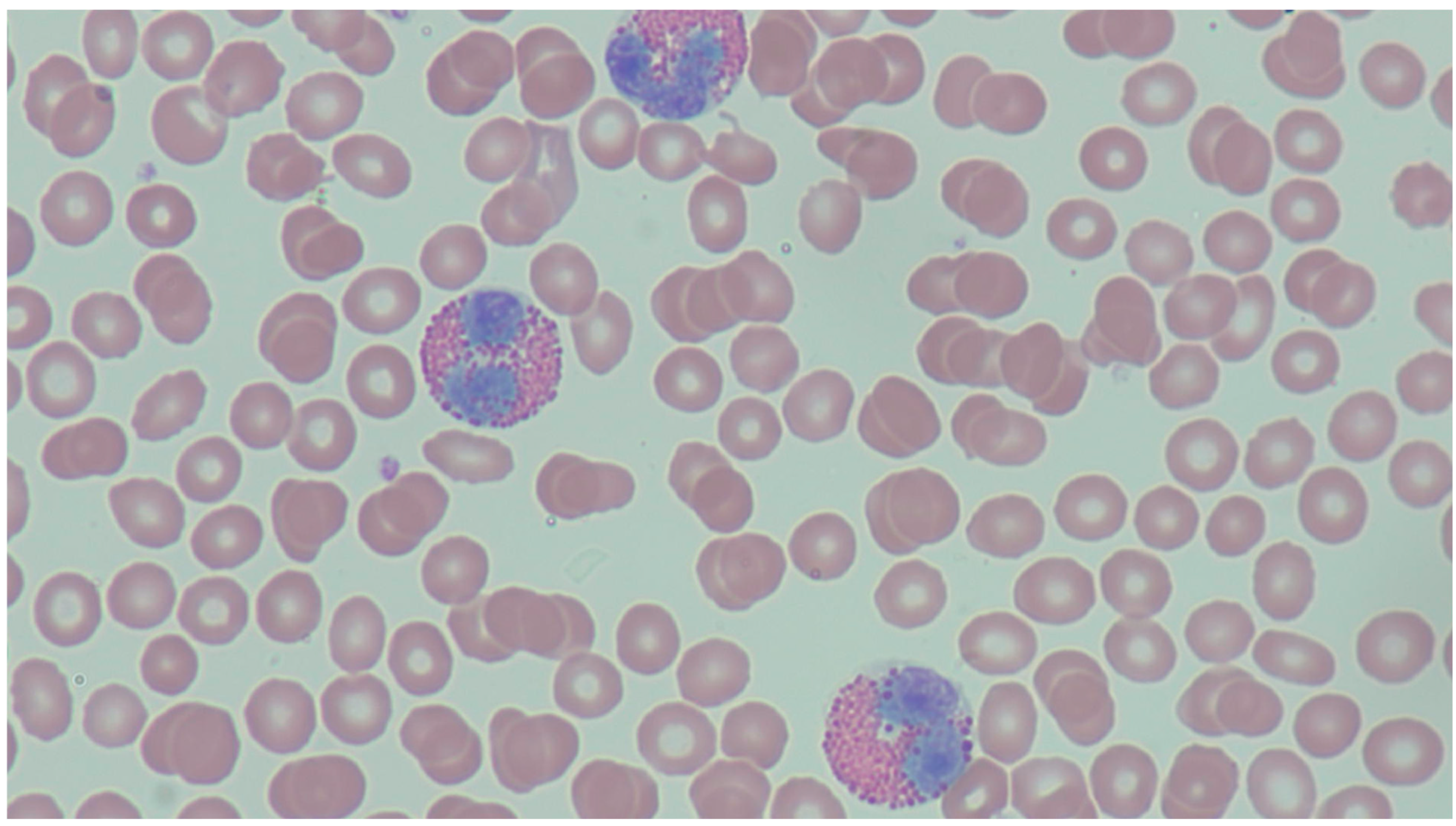 <p>What are the big cells near the RBCs?</p>