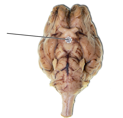 <p>Name the part of the brain that is highlighted.</p>
