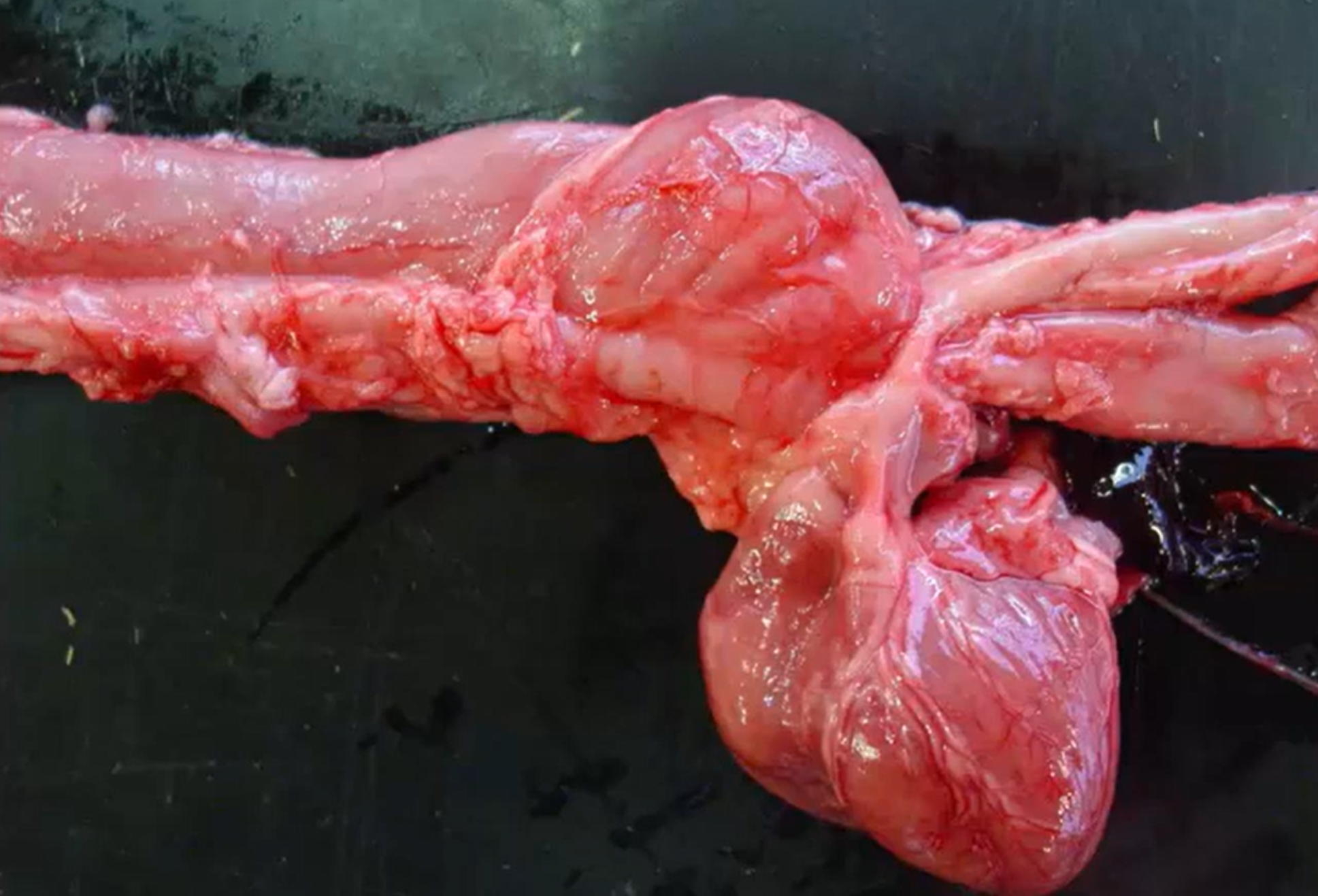 <ol><li><p>Persistent right aortic arch; vascular ring anomaly  </p></li><li><p>Proximal esophageal dilation; megaesophagus</p></li></ol><p></p>