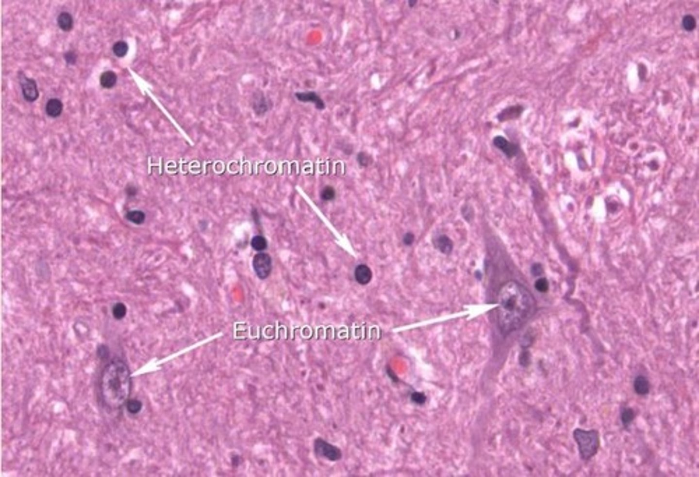 <p>- Highly condensed/tightly packed chromatin/DNA</p><p>- Transcriptionally SILENT/inactive</p><p>- Intense haematoxylin staining</p>