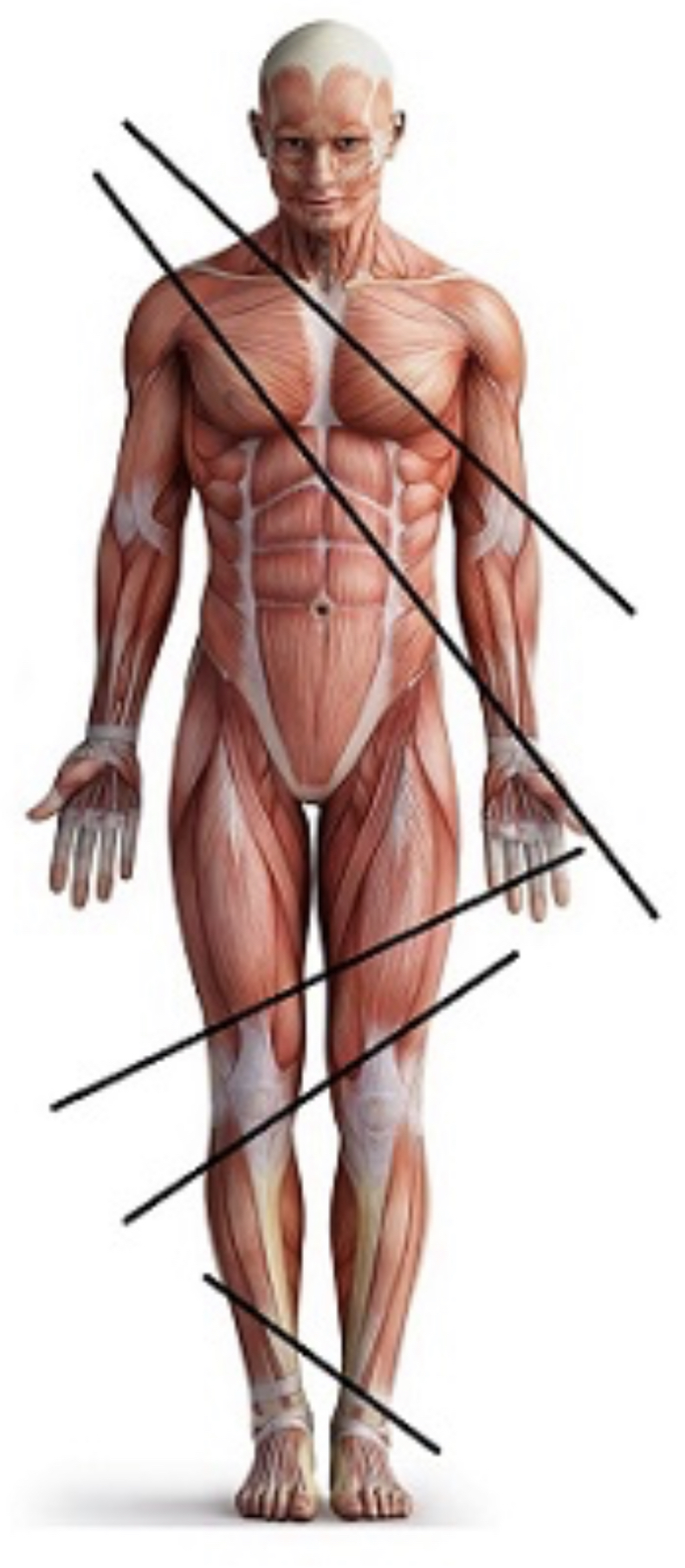 Oblique