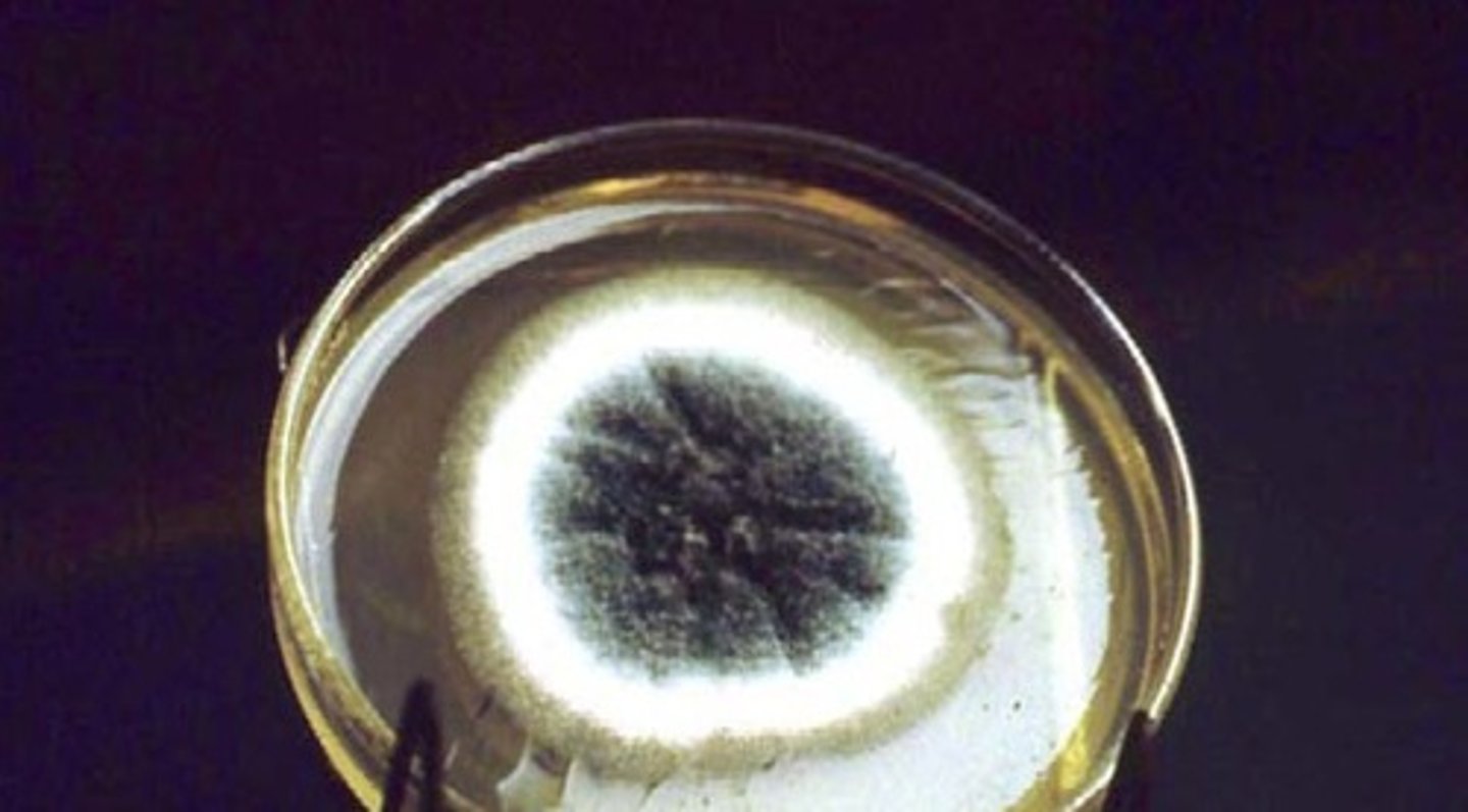 <p>a. Aspergillus fumigatus</p>