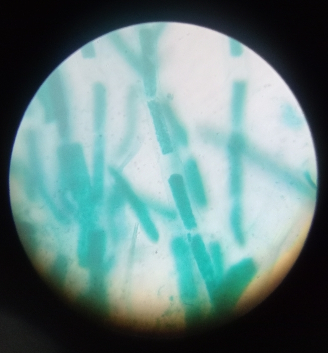 <p>Its name comes from Ancient Greek: kládos meaning “branch” and -phora meaning “bearing.”</p>