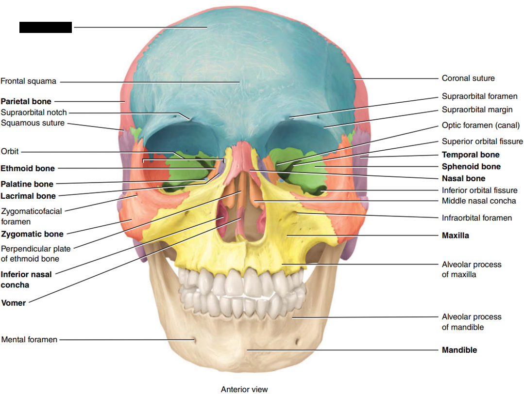 <p>State and identify which part of the cranial bone is being censored.</p>