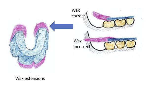 <p>the wax should slant upwards - follow the contours of the anatomy </p>