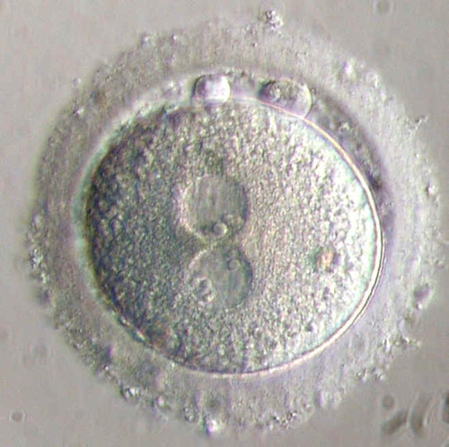 <p>Another term for a fertilised egg cell.</p>