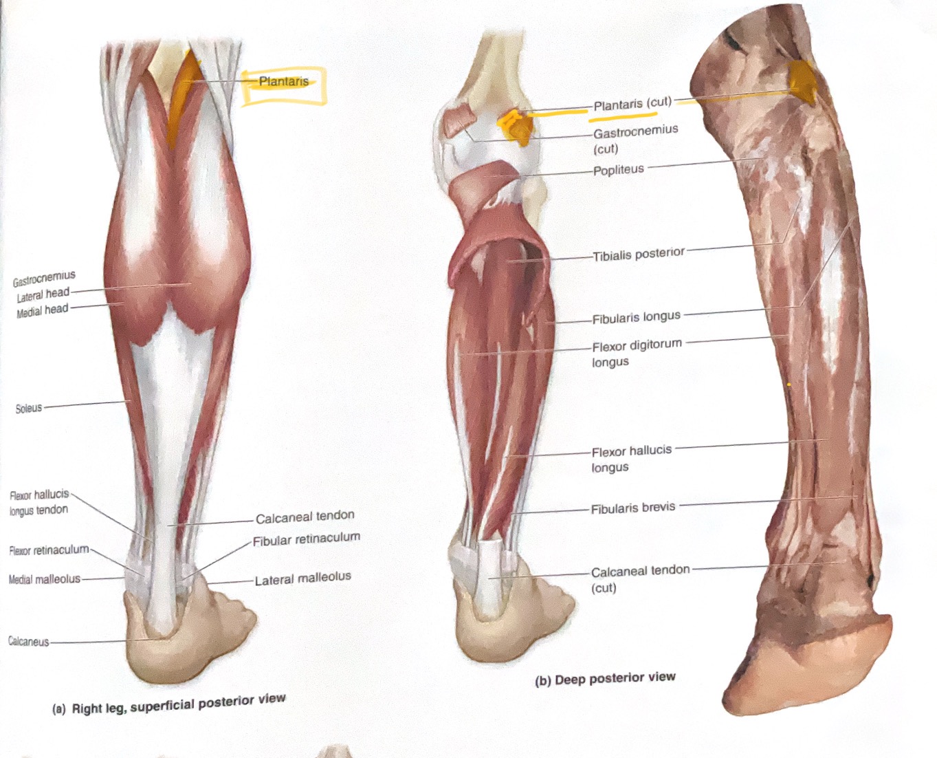 <p>Action: Plantar flex ankle</p>