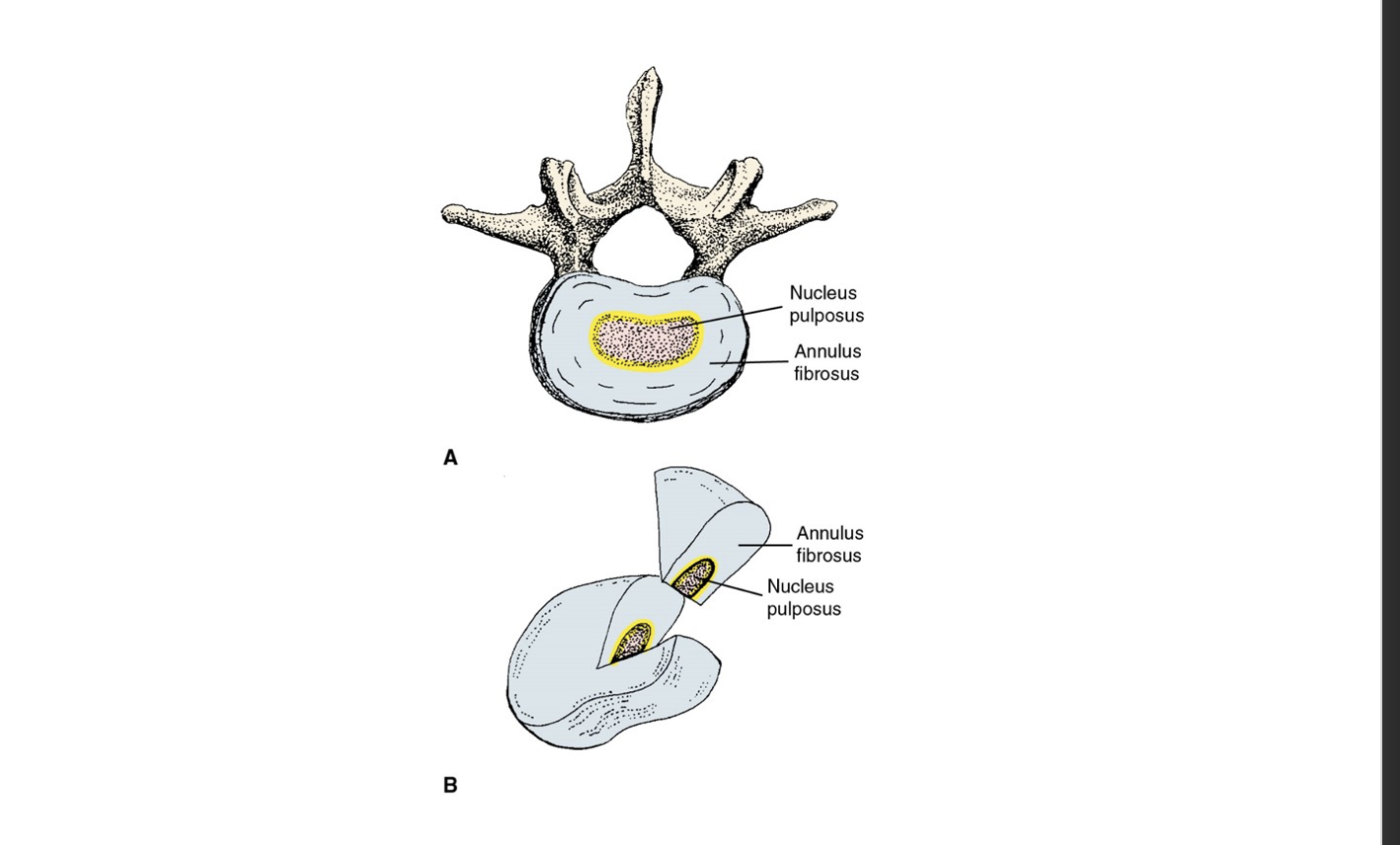 <p>consist of the annulus fibrosus and nucleus pulposus, which provide cushioning and absorb shock between vertebrae. </p>