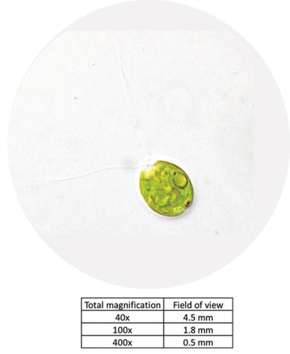 <p>You observe the above organism through a microscope with the 40x objective. Based on the image and the provided table, which of the following is the best estimate of this organisms size?</p>