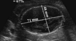 <p>calculated from using both of these measurements?</p>