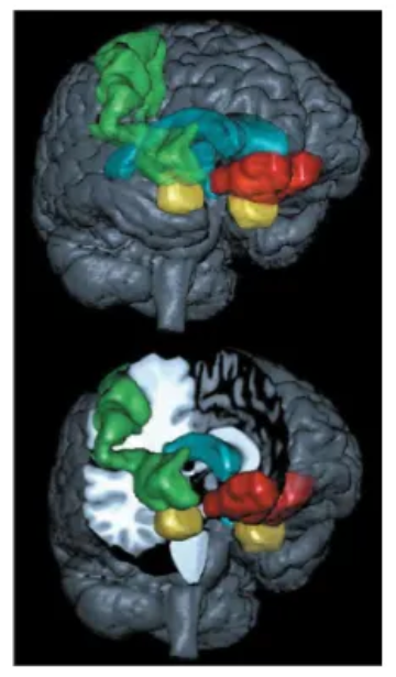 <ul><li><p>Amygdala (yellow)</p></li><li><p>Ventromedial Prefrontal Cortex (red)</p></li><li><p>Somatosensory Cortex (green)</p></li><li><p>Ventricles for orientation (blue)</p></li><li><p>V1 and FFA / OFA</p></li></ul><p></p>