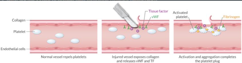 <p>After vascular injury occurs, platelets evolve into a platelet plug via a 3 step process:</p><ol><li><p>Adhesion</p></li><li><p>Activation</p></li><li><p>Aggregation</p></li></ol><p>The platelet plug is formed in ~5 minutes.</p>