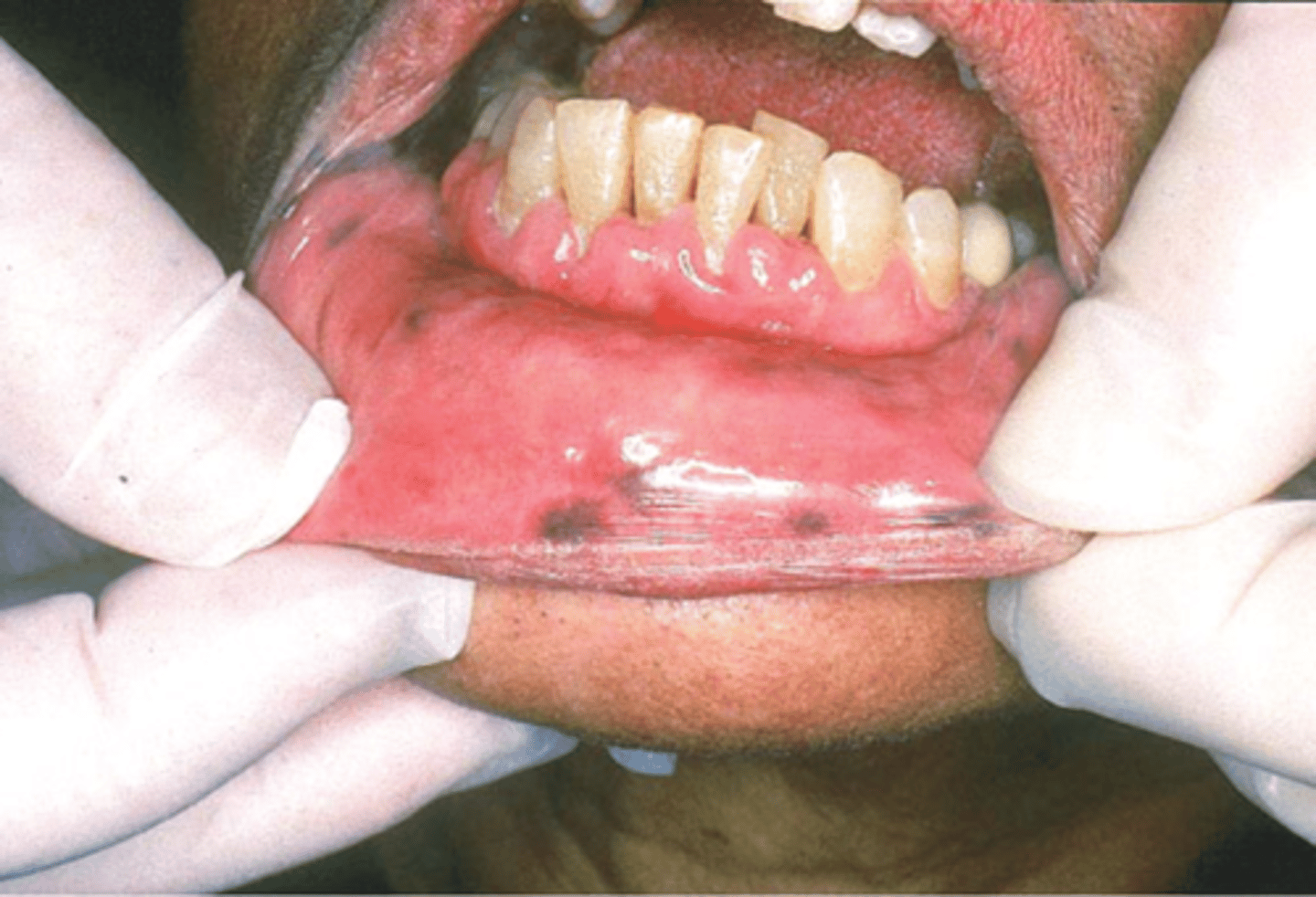 knowt flashcard image