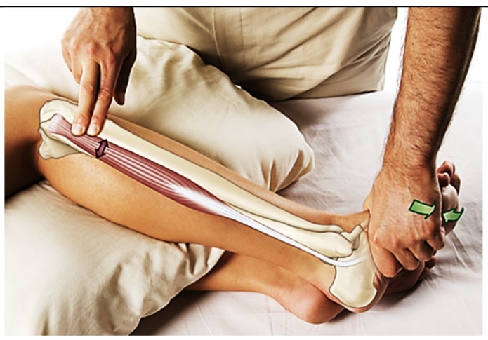 <p>peroneus longus</p>