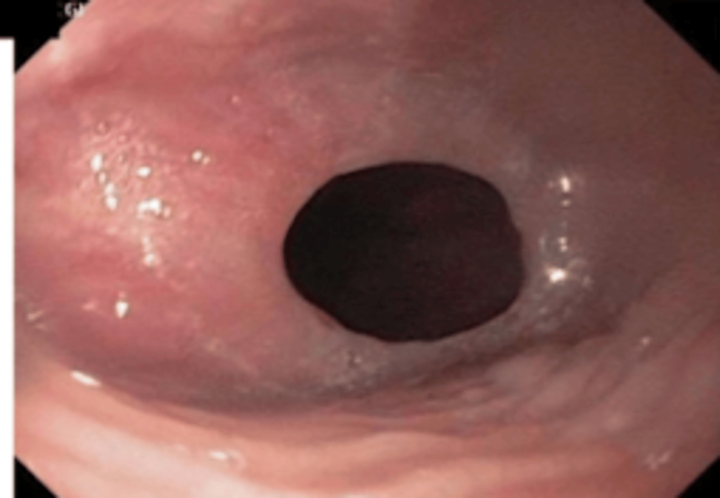 <p>what is the name of this disorder?</p>
