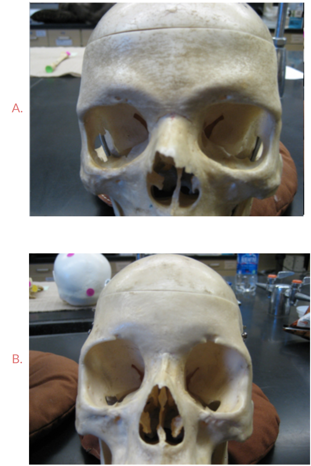 <p><span>Look at the brow ridges of these two skulls, which one is male? Answer A or B</span></p>