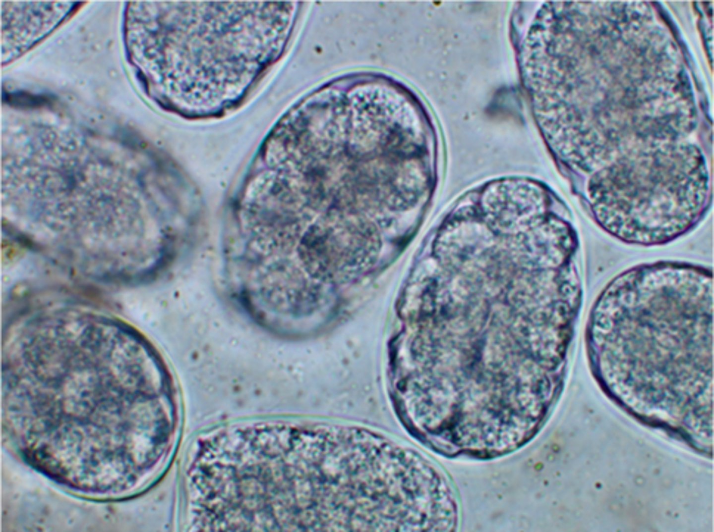 <p>Ingestion of infective larvae in mother's milk.</p><p>3 multiple choice options</p>