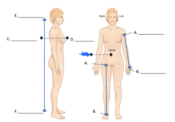 <p>What is this directional term?</p>