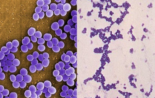 <p>Genus: Staphylococcus</p>
