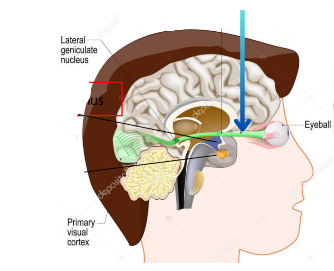 term image