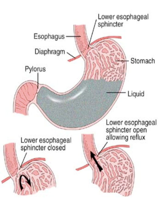 <p>Circular muscles that control the movement of food into and out of the stomach </p>