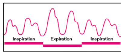 <p>= reduced intensity of pulse during inspiration and stronger with expiration </p><p><strong><u>causes</u></strong>:</p><ul><li><p>cardiac tamponade</p></li><li><p>pericarditis</p></li><li><p>chronic lung disease</p></li><li><p>acute pulmonary embolus</p></li><li><p>hypovolemic shock</p></li><li><p>pregnancy</p></li></ul>