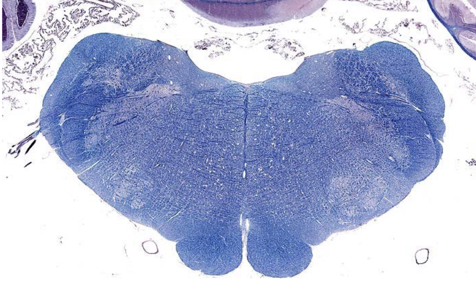 <p>what section of the brain is shown?</p>