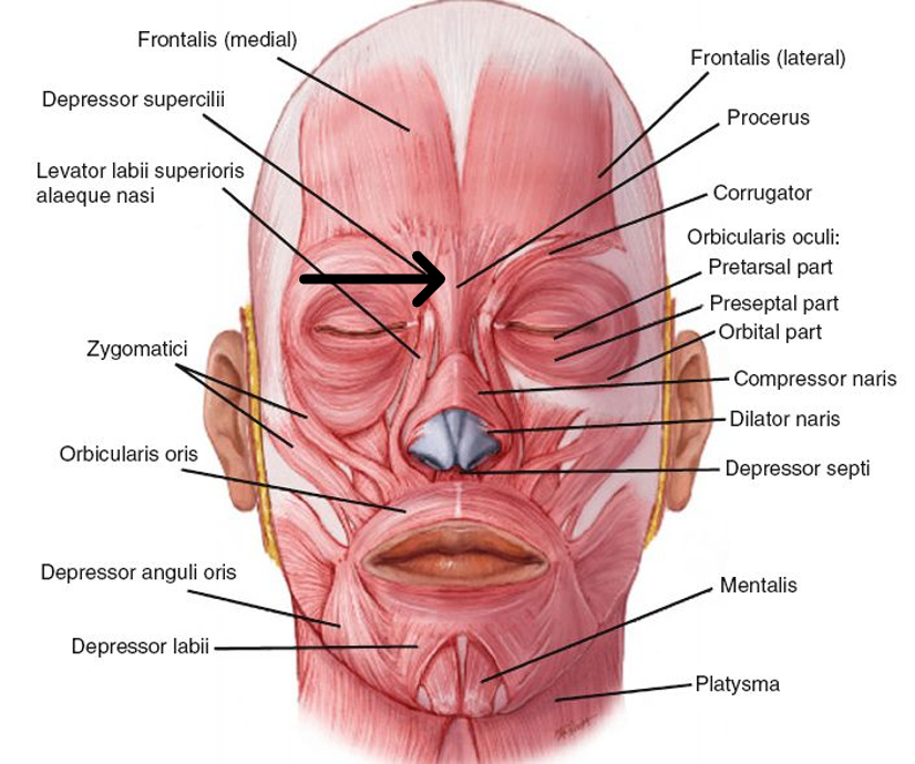 <p>innervation: CN VII</p><p>acton: wrinkle nose</p>